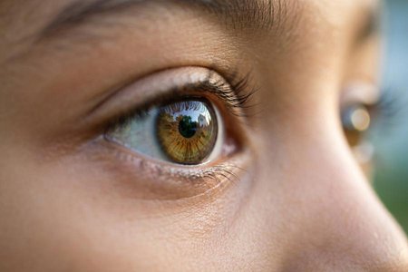 An image of the word myopia as defined by a condition of the eye in which parallel rays are focused in front of the retina, objects being seen distinctly only when near to the eye; nearsightedness (opposed to hyperopia).